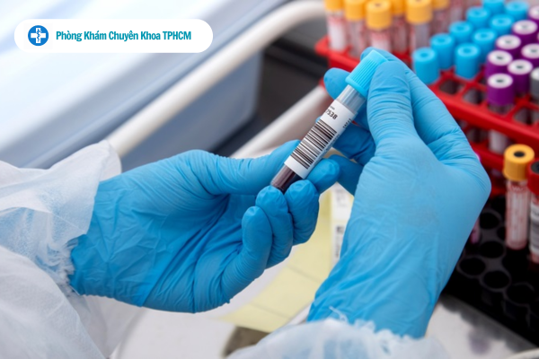 Địa chỉ xét nghiệm bệnh xã hội uy tín quận 1